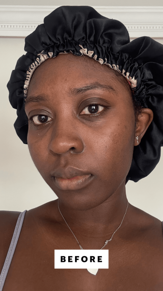 BlayTettey before applying the Dr. Diamonds Metacine Instafacial Plasma